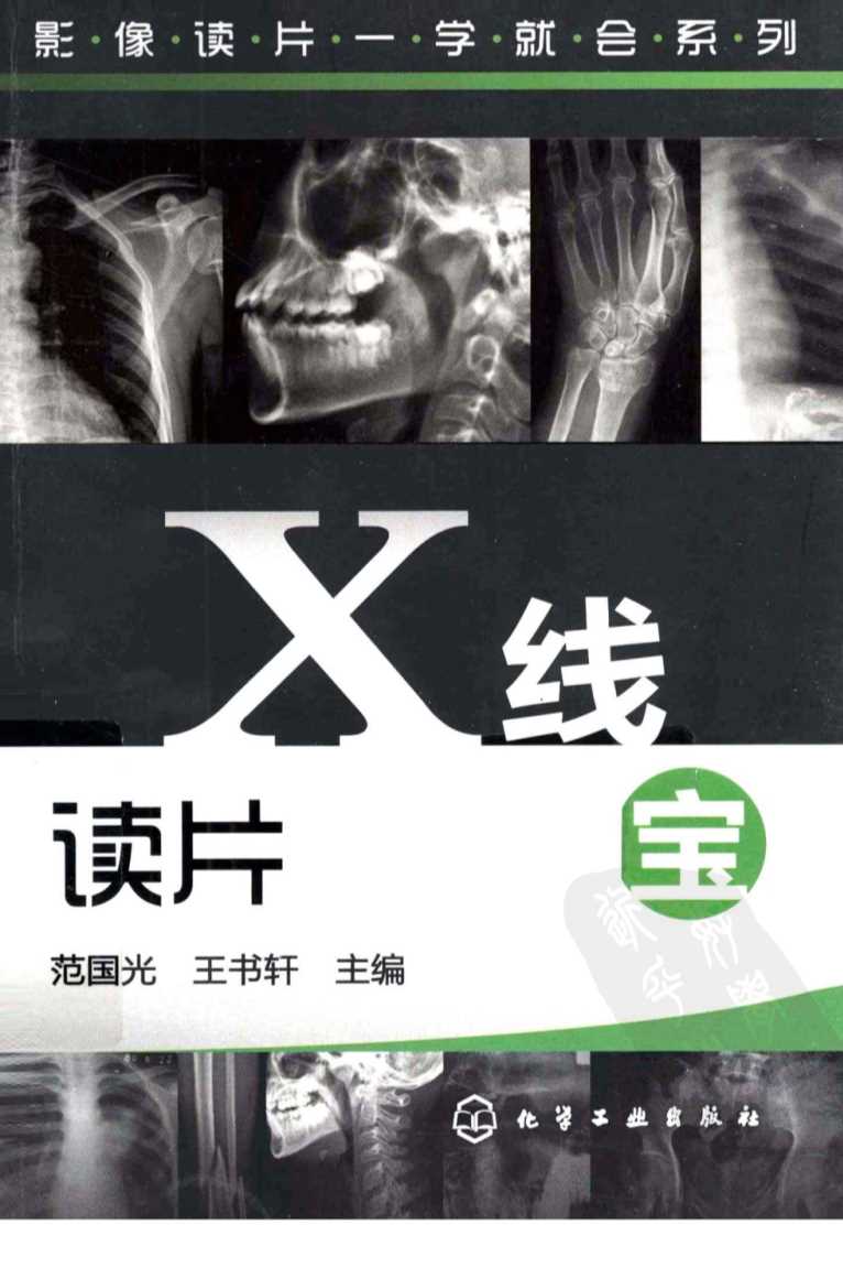 X线读片掌中宝-范国光，王书轩主编