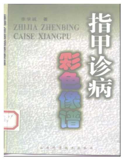 指甲诊病彩色像谱-李学诚