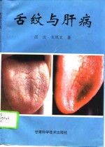 舌纹与肝病