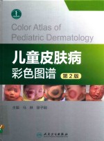 儿童皮肤病彩色图谱  第2版