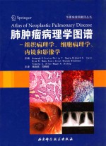 肺肿瘤病理学图谱  组织病理学、细胞病理学、内镜和影响学