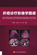 肝癌诊疗影像学图谱