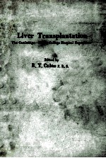 liver transplantation_the cambridge-king's college hospital experience